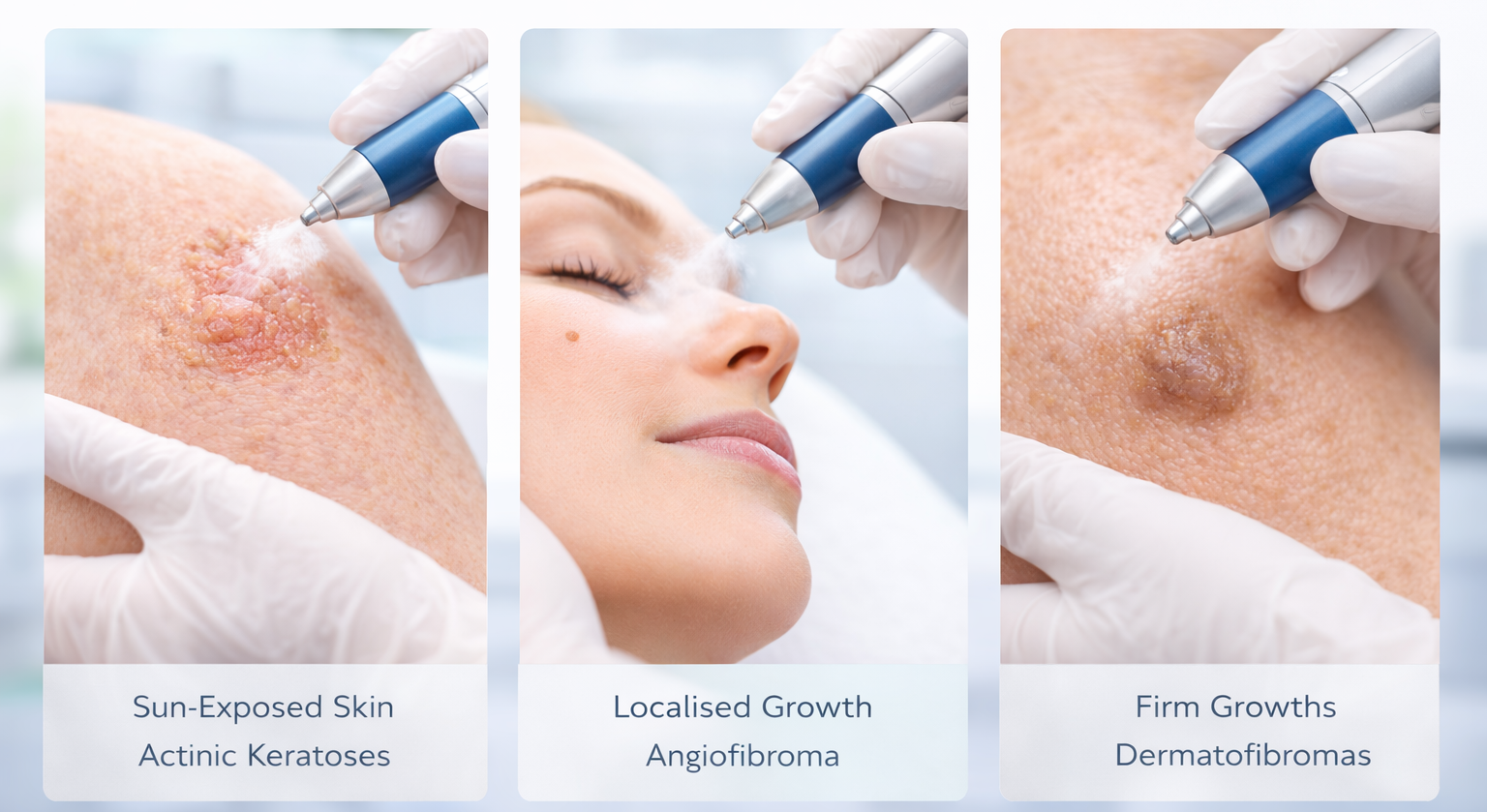 Illustration of precision in skin treatment